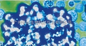 试剂盒